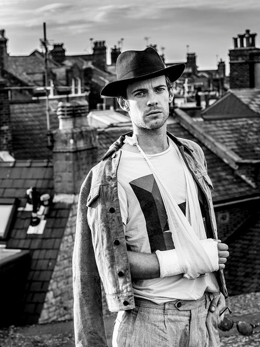 Harry Treadaway "Broke my Arm"